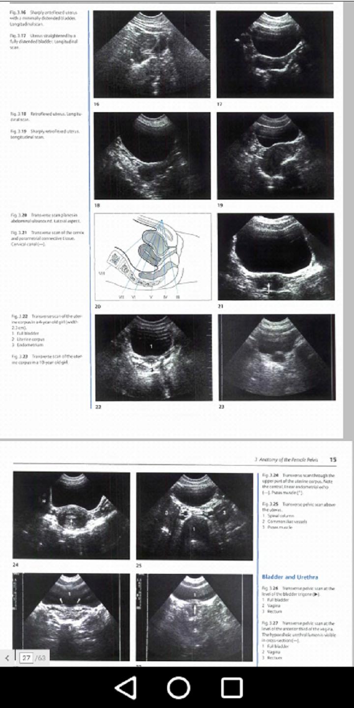 Gynecology - Ultrasound in Obs